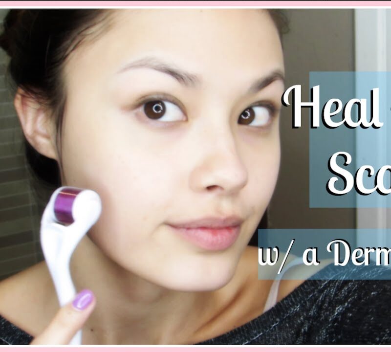 HOW TO TREAT ACNE SCARS & IMPROVE YOUR SKIN’S APPEARANCE